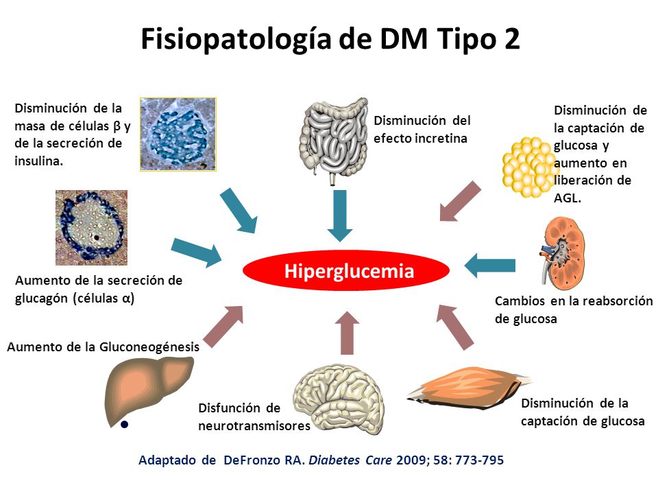 Fisiopatologia Diabetes Mellitus Gestacional Pdf 2019